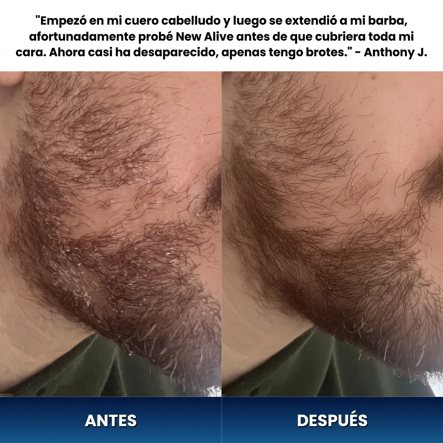 New Alive® Crema Antifúngica Reparadora