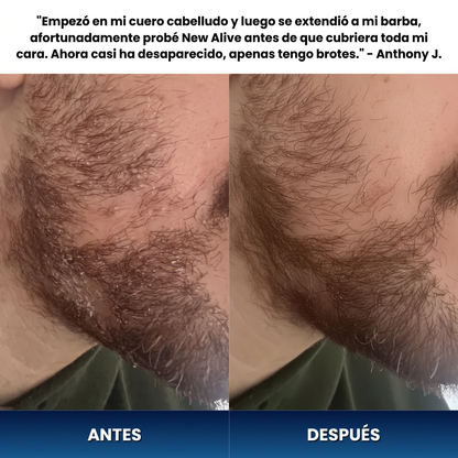 New Alive® Crema Antifúngica Reparadora