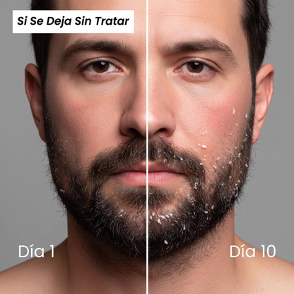 New Alive® Crema Antifúngica Reparadora
